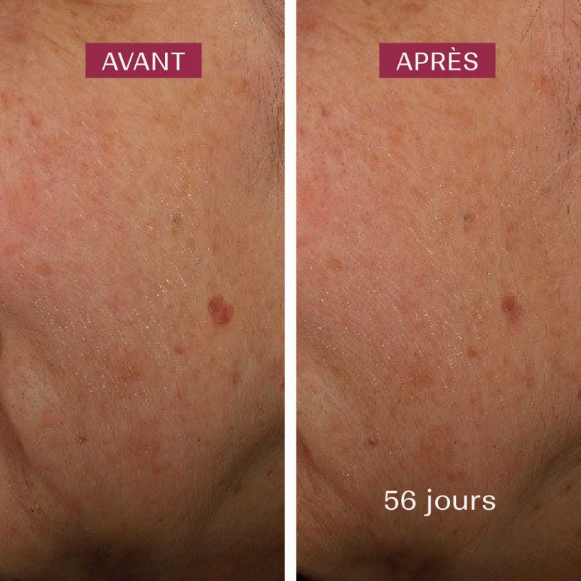 serum visage