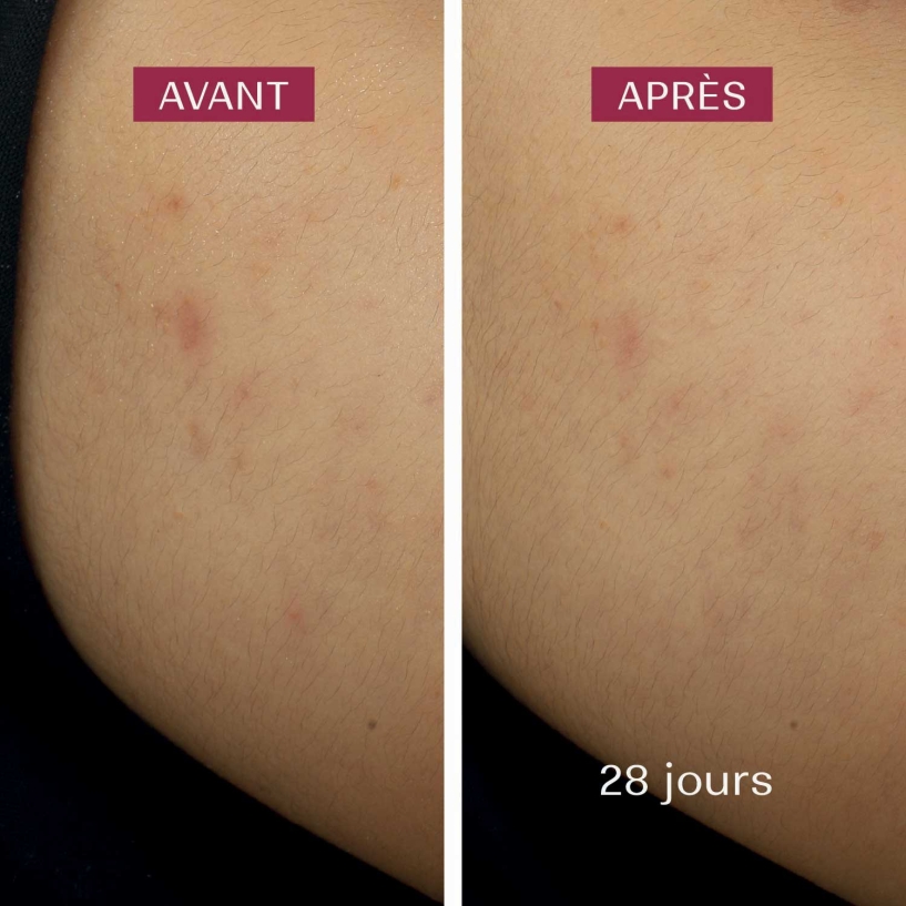 soin anti-taches
