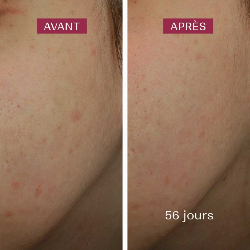 produit anti taches visage