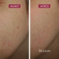 produit anti taches visage