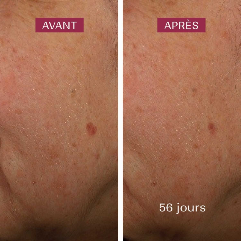 crème anti taches brunes