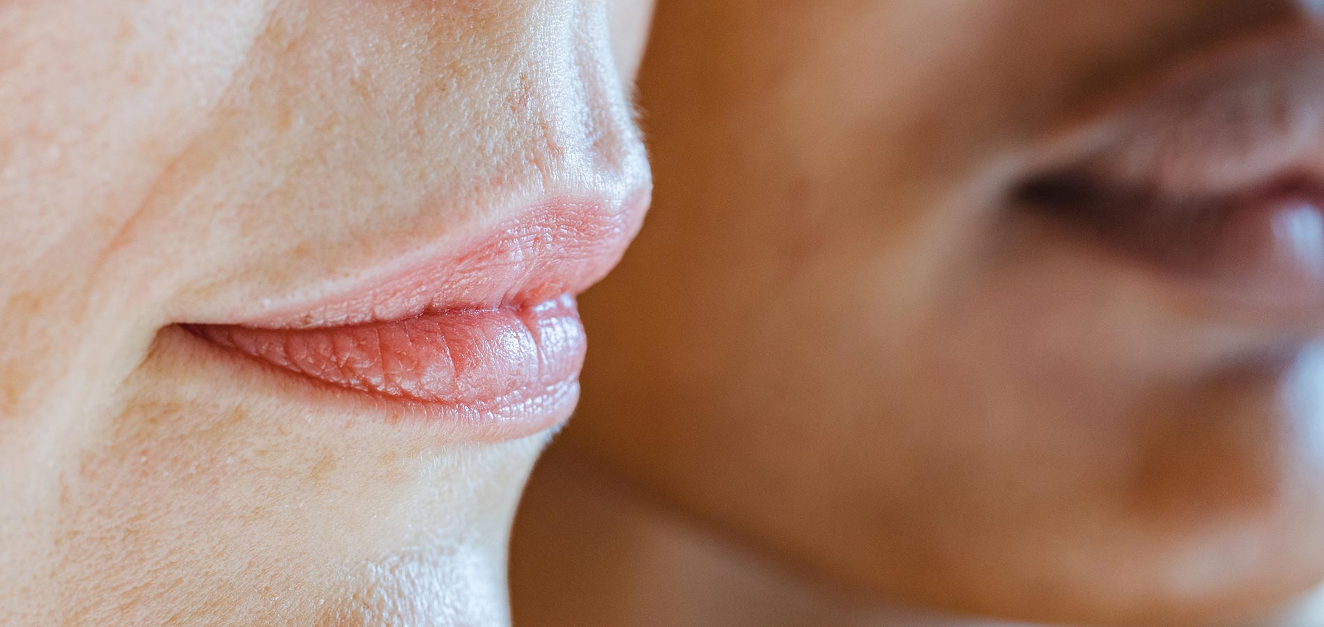 How to prevent and treat lip sunburn