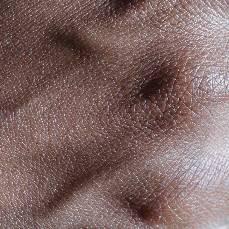texture d'une peau ridée